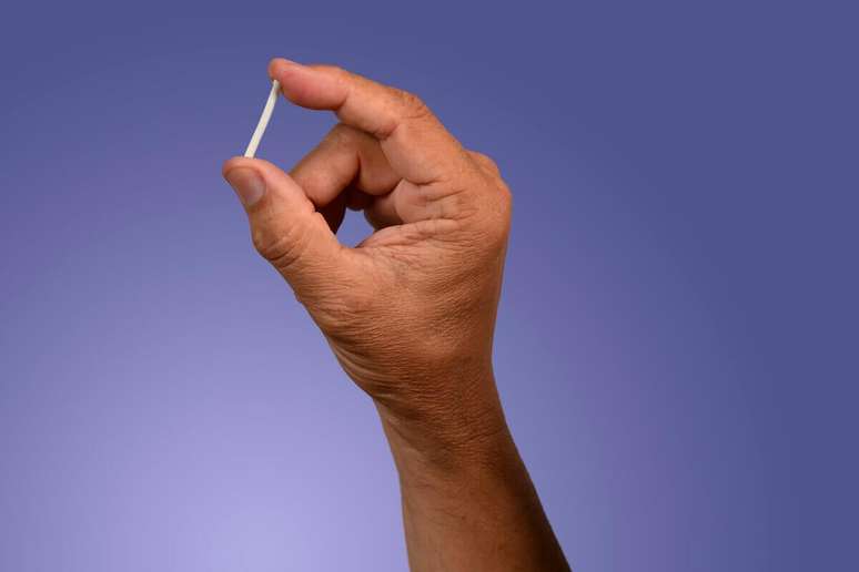 Implanon é um dos métodos contraceptivos mais eficazes