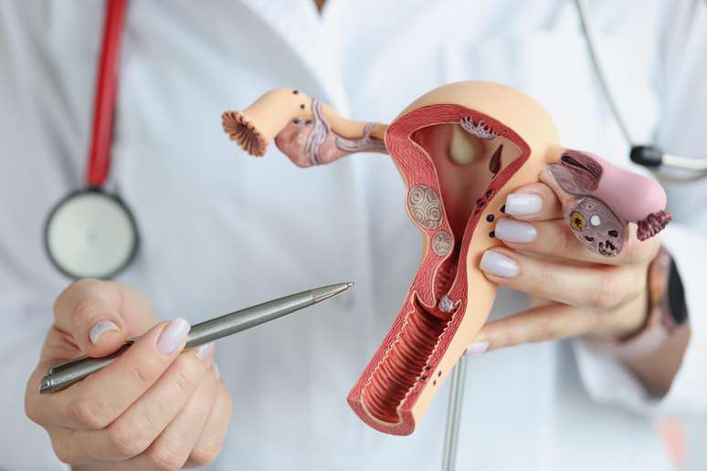 Imagem meramente ilustrativa de uma médica mostrando o ovário