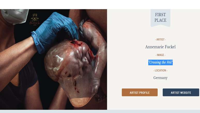 Printscreen do site do concurso de fotografia. &Agrave; esquerda, a foto vencedora de um beb&ecirc; empelicado assim que retirado do &uacute;tero. &Agrave; direita, as informa&ccedil;&otilde;es da foto.