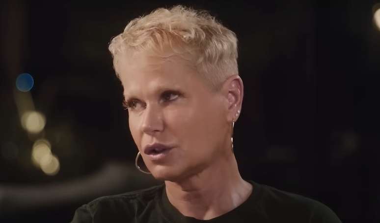 Xuxa não revelou o nome do cirurgião, mas afirmou que ele fazia diversos procedimentos por dia