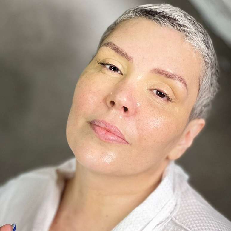 Cantora Simony enfrenta luta contra o câncer