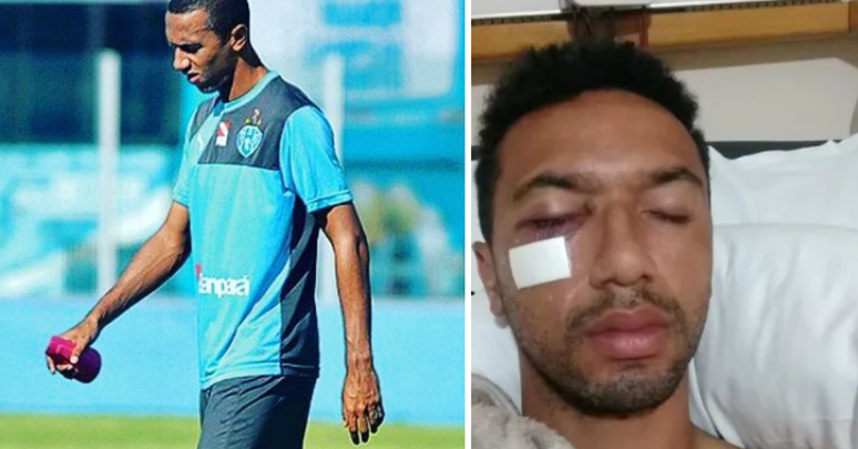 Ex-base do Palmeiras, zagueiro faz vaquinha para realizar cirurgia de urgência