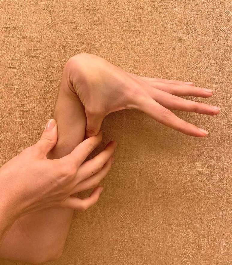 Desde pequena, Sinaria tem uma hipermobilidade fora do comum