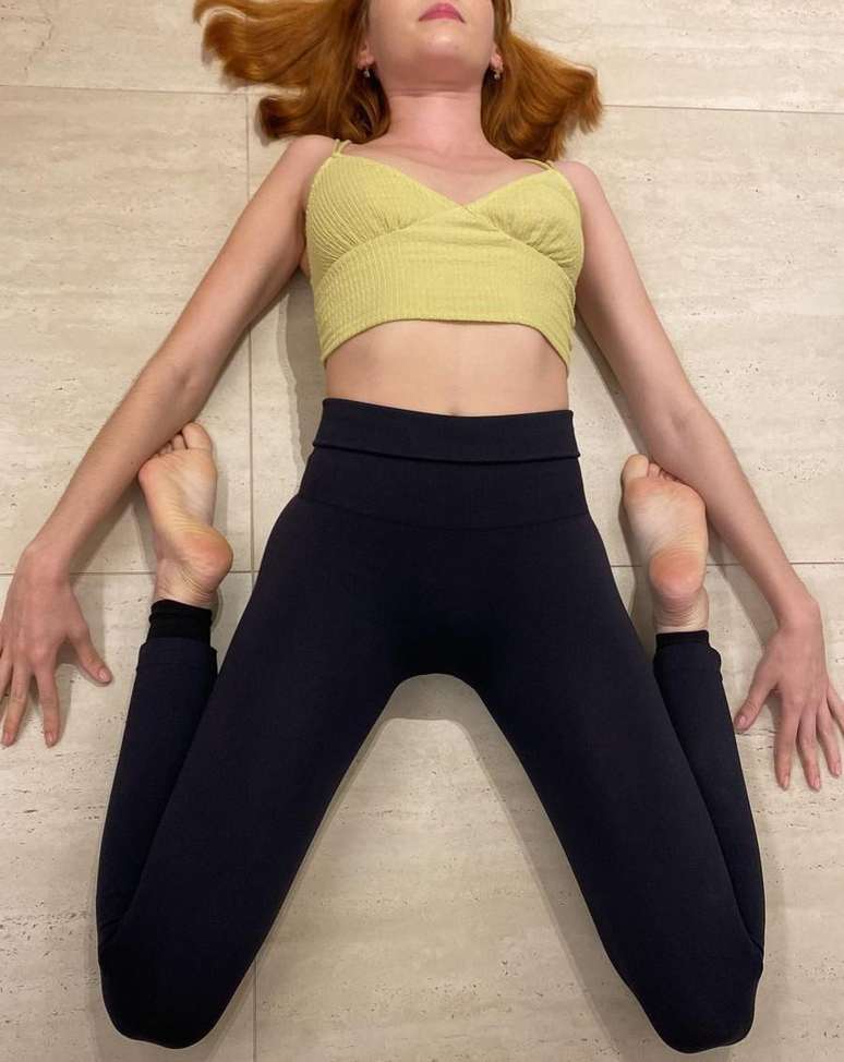 Ela sofria constantemente com luxa&ccedil;&otilde;es e tor&ccedil;&otilde;es, simplesmente por brincar usando o seu corpo