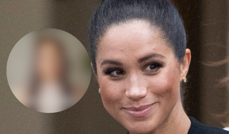 Meghan Markle fez cirurgia plástica recentemente?.