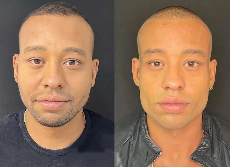 Ant&ocirc;nio Carlos o Mussunzinho