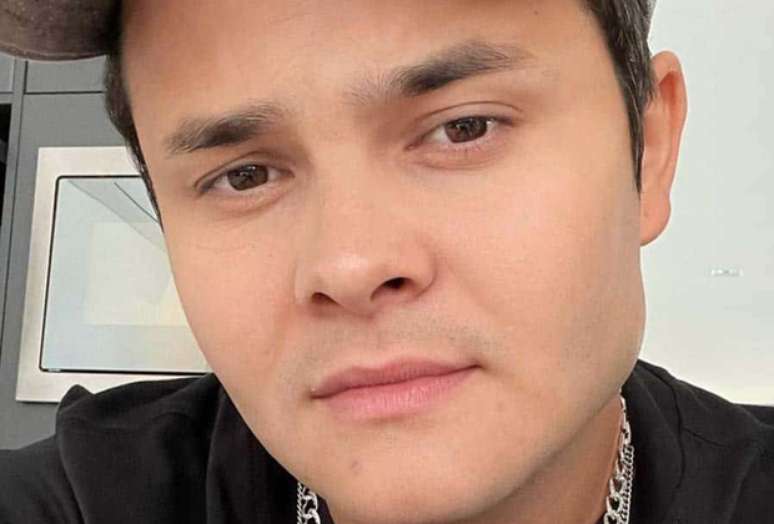 Matheus, of the duo with Kauan, undergoes lipo and hair transplant