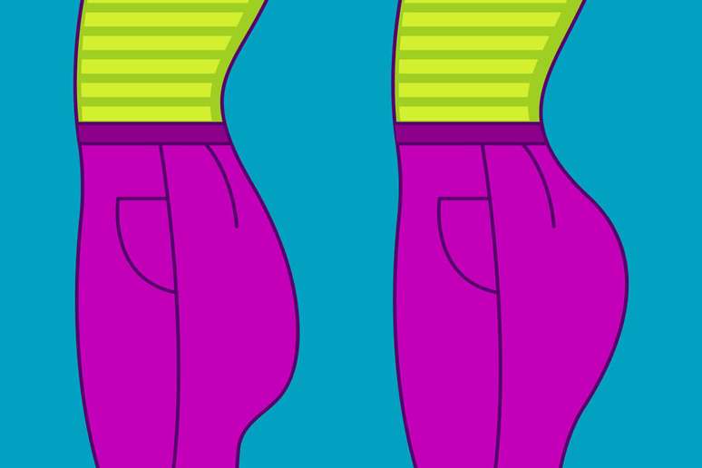 Procedimento est&eacute;tico real&ccedil;a o formato e empina os gl&uacute;teos 