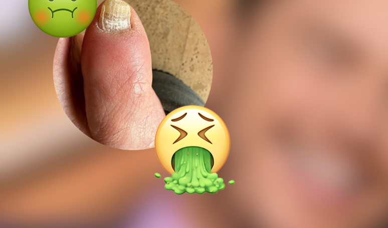 ECA, who sees a heartthrob, doesn’t see a nail: Discover the actor who disgusted followers with a photo of his bizarre foot