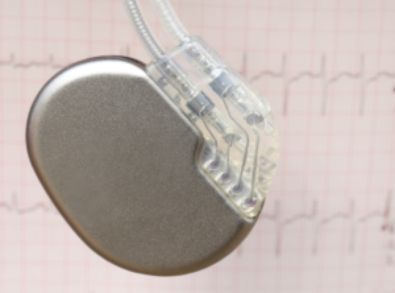 Life after the pacemaker