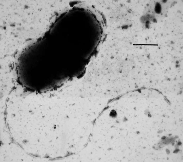 A specimen of Desulfovibrio vulgaris, a bacterium that may be the main environmental cause of the development of Parkinson's disease (Image: Graham Bradley/Public Domain) A specimen of Desulfovibrio vulgaris, a bacterium that may be the main environmental cause of the development of Parkinson's disease (Image: Graham Bradley/Public Domain)