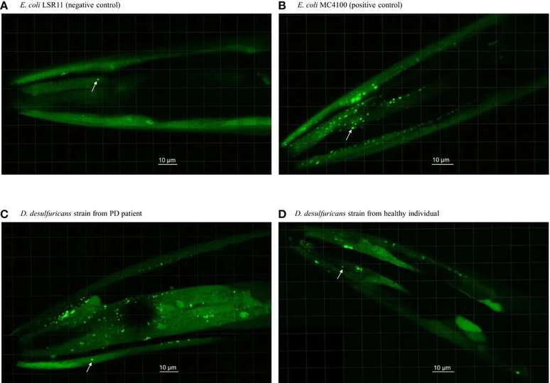 In the image, you can see the study nematode with clusters of alpha-synuclein, the bright spots highlighted (Image: Huynh et al./Front. Cell. Infect. Microbiol.) In the image, you can see the study nematode with clusters of alpha-synuclein, the bright spots highlighted (Image: Huynh et al./Front. Cell. Infect. Microbiol.)