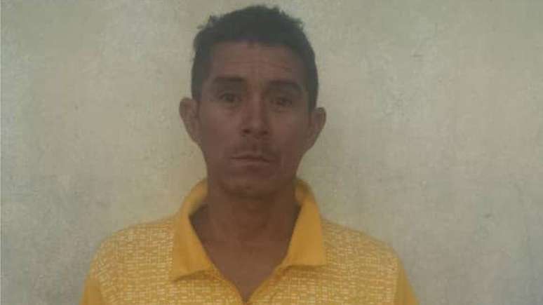 A esposa de Rudy morreu h&aacute; um ano e meio ap&oacute;s sofrer problemas na ves&iacute;cula