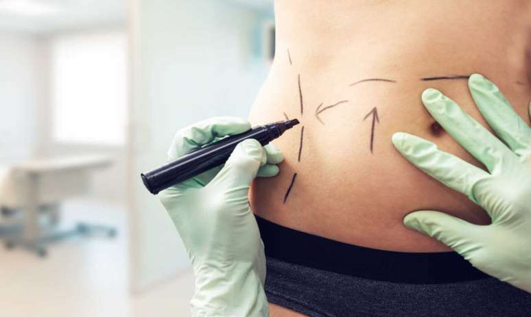 Cirurgia devolve autoestima após o parto: o que é o mommy makeover? -