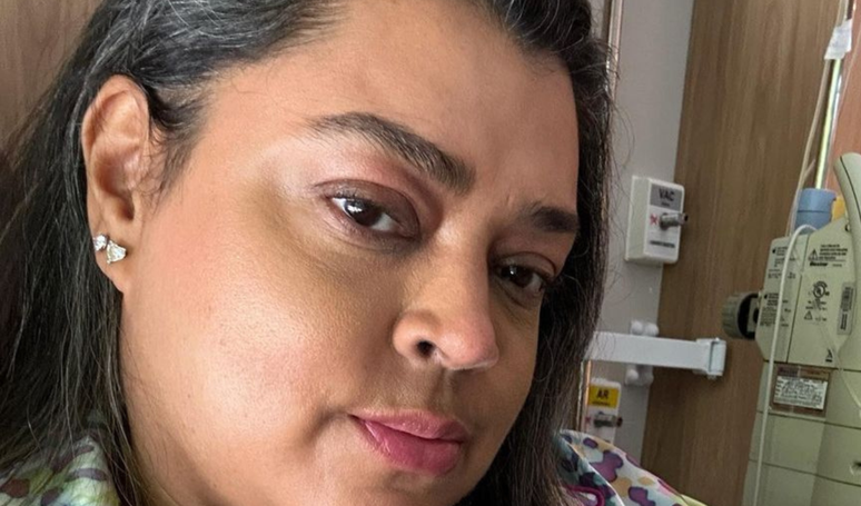 ‘Solutions for my lack of hair’: Preta Gil tries a ‘trick’ to overcome hair loss while battling cancer