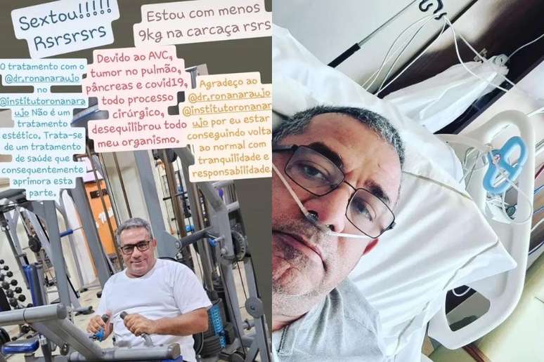 "Painitto" contou sobre tratamentos de saúde no Instagram