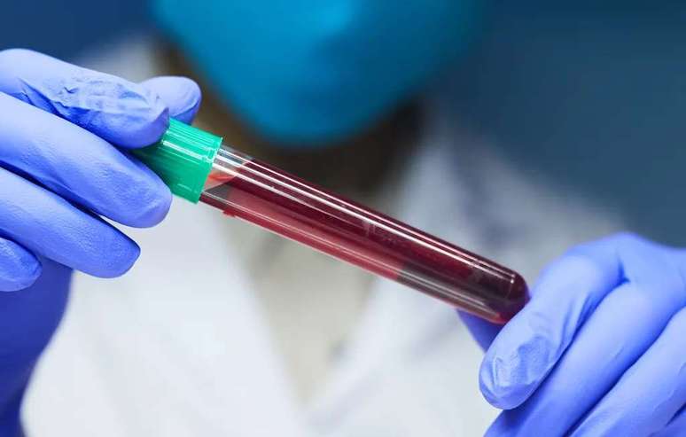 In the United States, a man receives blood transfusions from his son to slow aging (Image: Seventyfourimages/Envato)