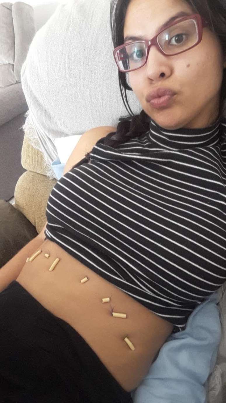 Aos 28 anos, Carem passou pela transposi&ccedil;&atilde;o de &oacute;rg&atilde;os, ap&oacute;s descobrir um c&acirc;ncer na pelve e precisar fazer sess&otilde;es de radioterapia