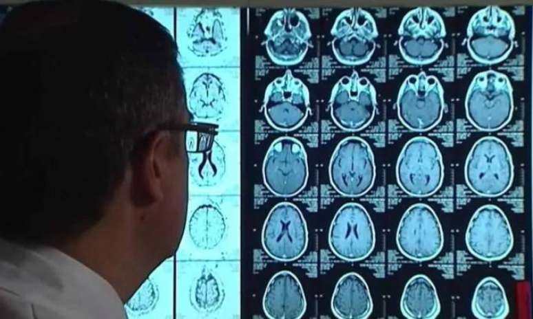 Descrição da imagem #pracegover: Homem de óculos e roupa branca está de costas para a câmera e olha para a tela de um computador onde estão projetadas imagens de um exame cerebral.