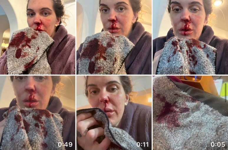 Gabi postou diversas imagens em que aparece sangrando