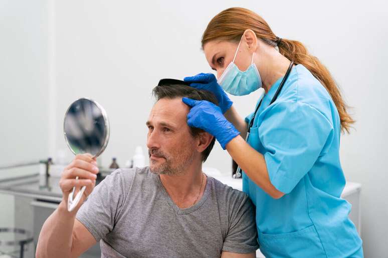 Diagnosing alopecia can be done in several ways 