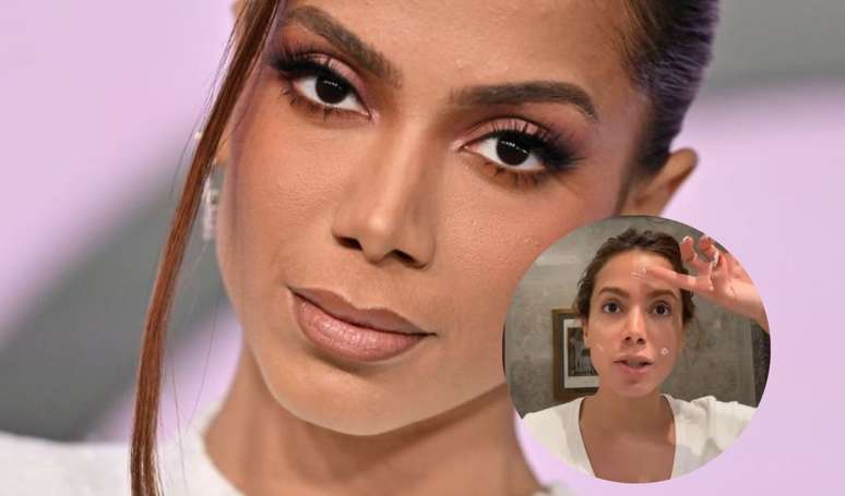 Proibido no Brasil: segredo de Anitta no skincare é feito do sangue da cantora; dermatologista opina.