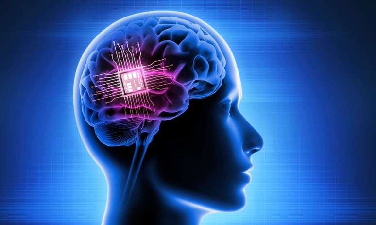 Elon Musk tem autorização para testar chip cerebral em humanos; há riscos? -