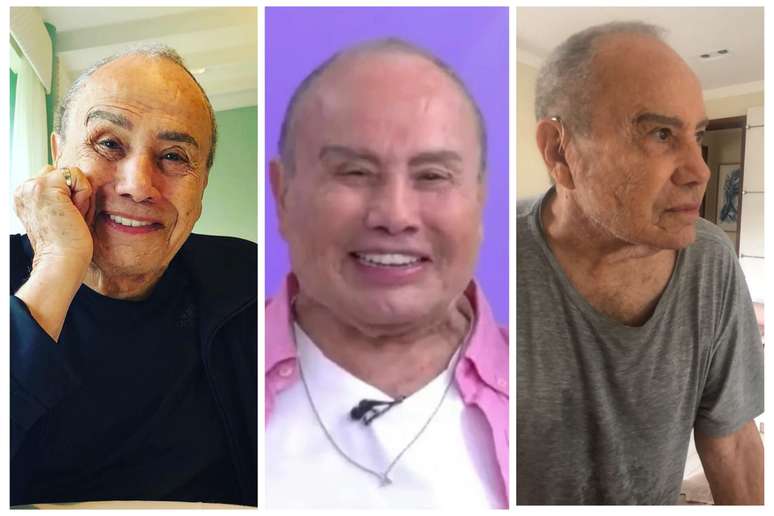 Stenio Garcia antes da harmonização facial, com rosto inchado após uso de medicações e dias após o procedimento, já em processo de desinchaço