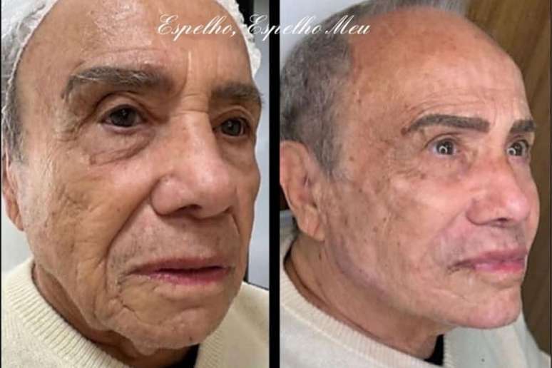 Facial Harmonization: The plastic surgeon answers the questions