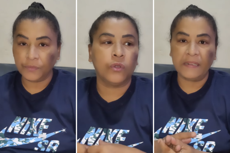 MC Kátia, que fez clipe com Ludmilla, revela problema de saúde