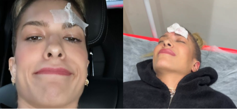 Lore Improta is injured at home and gets stitches on her forehead: “A lot of blood”