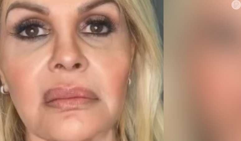 Monique Evans’ facial harmonization surprises the web.  Check out the before and after of the model!