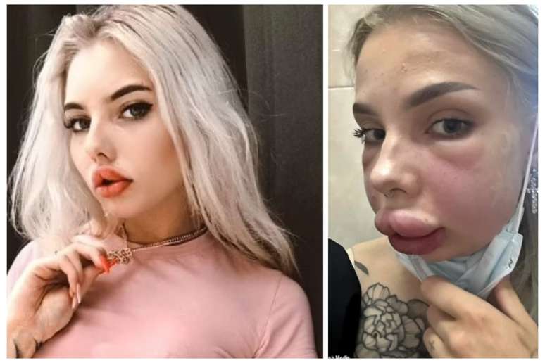 Cartier Bugatti, de 22 anos