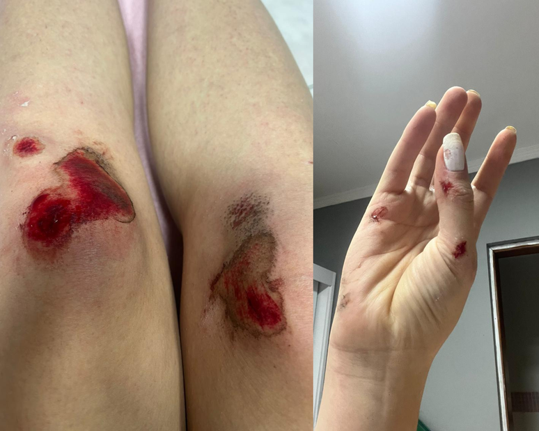 O registro de boletim de ocorrência online foi feito pela vítima, porém ela pretende abrir outro presencialmente na delegacia.  