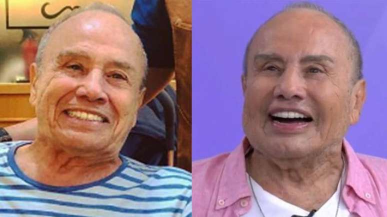Stenio Garcia antes e depois da harmonização facial