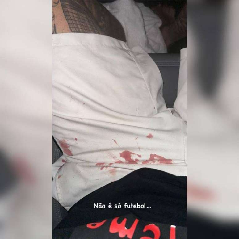 Luan, do Corinthians, exibe marcas de sangue em sua roupa após ser agredido.