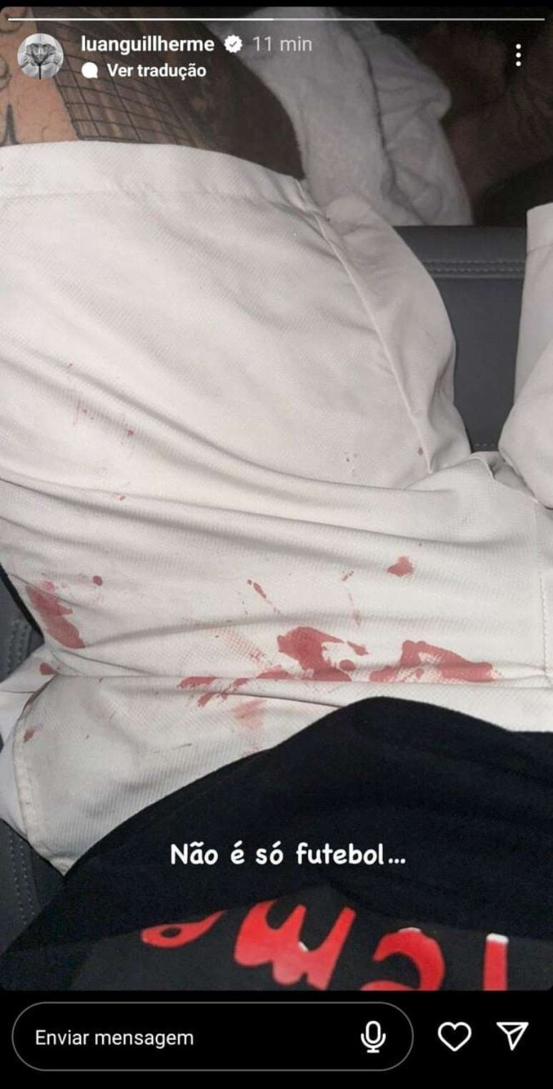Luan, from Corinthians, posts a photo in bloody shorts after being attacked in a motel