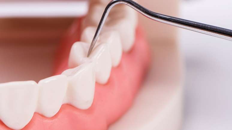 How does tooth loss affect health?