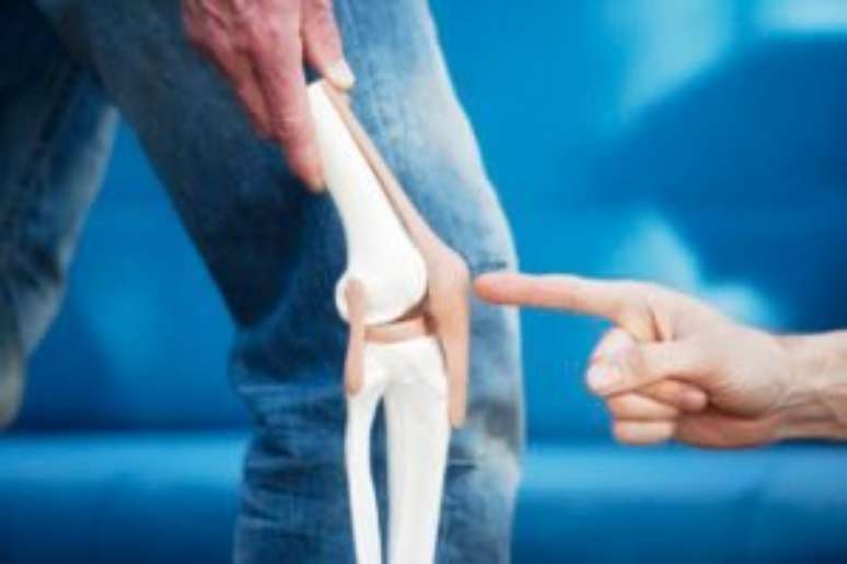 The 4 stages of osteoarthritis