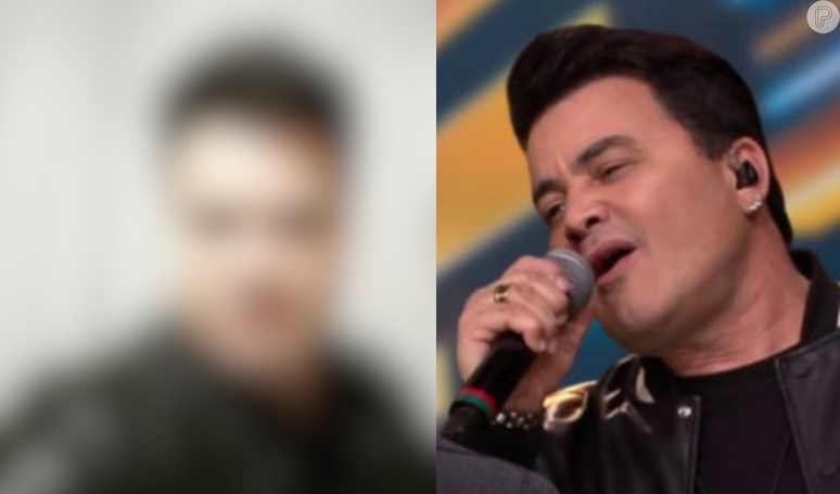 Sertanejo Renner faz harmonização facial na mesma clínica de Stenio Garcia e resultado impressiona.