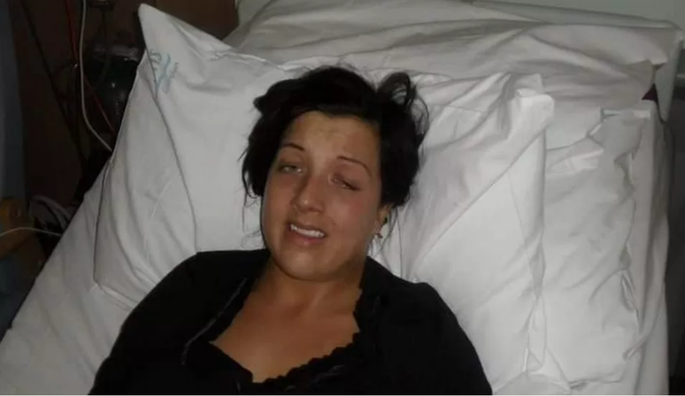 Leann spent months in the hospital following botched surgery.