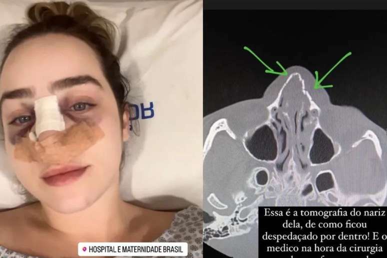 Estela Frohlich foi encaminhada para um hospital particular.