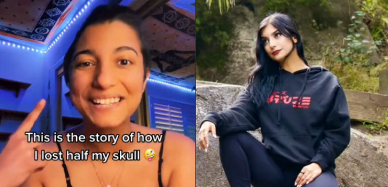 Natasha Santana contou com detalhes como passou pelas cirurgias de retirada de cr&acirc;nio