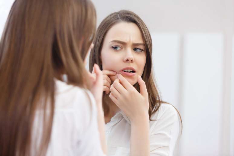 Mudan&ccedil;as hormonais influenciam no aparecimento de acne na adolesc&ecirc;ncia 