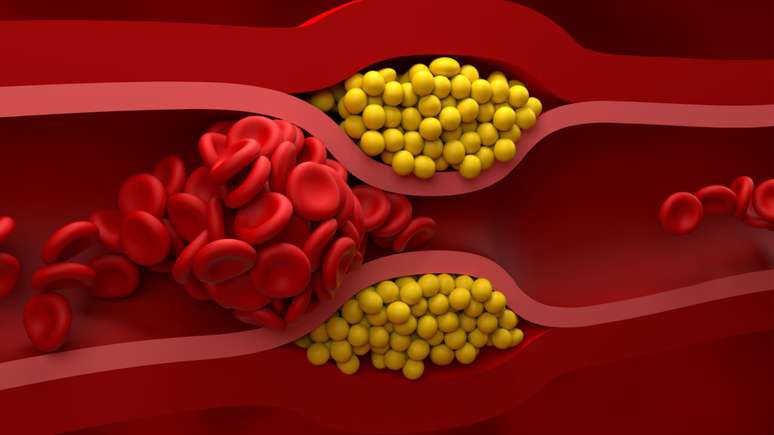 Dia Nacional de Combate ao Colesterol - Shutterstock