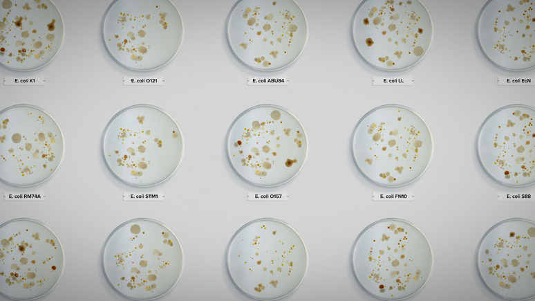 A bactéria E. coli pode levar a uma infecção muito grave
