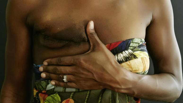A mastectomy is often needed in the fight against this type of cancer.