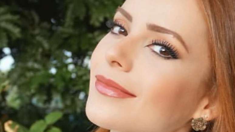 Sandy almost had plastic surgery after the accident