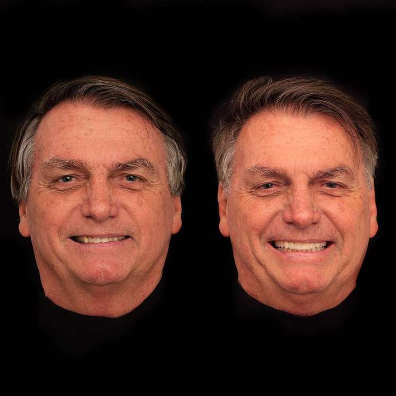 Procedimento estético nos dentes feito por Bolsonaro em Goiânia