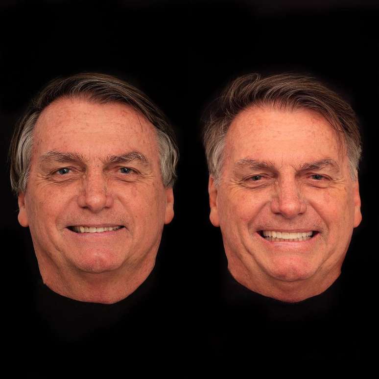 Bolsonaro faz harmoniza&ccedil;&atilde;o orofacial